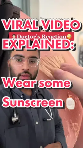 #duet with @kam.okay #foryou #sunscreen #sunburn #lotion #doctor #doctorsreaction #tiktokdoctor #physiciansoftiktok #physician