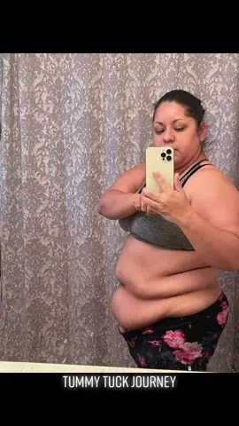 #tummytuckjourney #motivation #inspiration #ificanyoucan