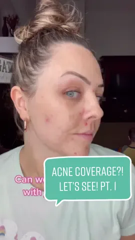 My ladies who struggle with acne - are you ready to NOT have to cake on your makeup anymore?! Let’s think strategy over layers! Follow for the blend in part 2! #makeupforacne #adultacne #acneover30 #quickmakeup