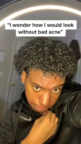 #greenscreenvideo #acne #skincare