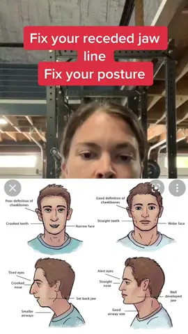 Fix your receded jaw line by strengthening your tongue and keeping it pressed to the roof of your mouth #tongueexercises #mewing #fascia #posture #exercise #workout #jaw #face