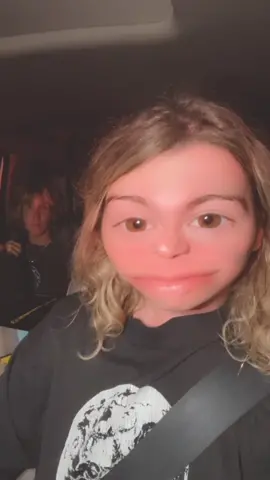 Beach Day..Why did I think it was a good idea? #sunburn #StEvEn #beachday #summervibes