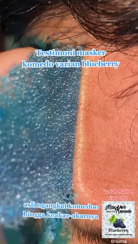 testimoni pemakaian masker Komedo asli ngangkat hingga keakar-akarnya hanya 10,000/pcs#maskerkomedosiskachic #maskerviral #maskerkomedo #ampuhbangett #maskerkomedobysiskachic