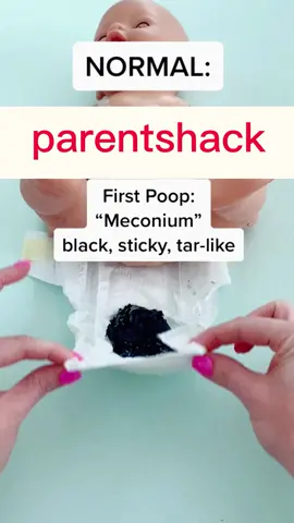 about baby: normal #newborn #newbaby #babytips #momhack #parenthack #newmom #newbornbabies #babypoop（vidfrom: Nurse Carly)