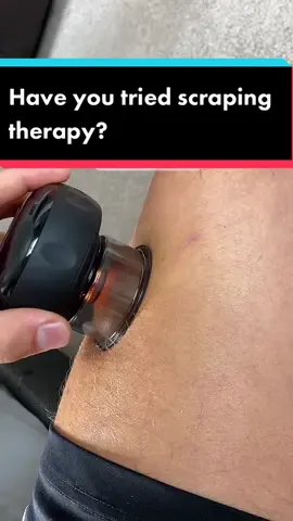 Its better than the candle and cup trick 🤫#massage #scraping #therapy #relax #nice #feeling #good #cuppingtherapy #cup #fyp #fypシ
