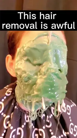 When a woman’s whole face is covered with wax #waxing #wax #hairremoval #shave #bodywaxing #fyp