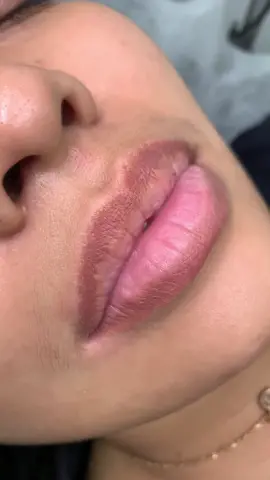 Ai muón xem kết quả thì qua trang của Myy nha . Siêu siêu tự nhiên luôn #laserco2franctional #Môi #nghiệnlàmđẹp