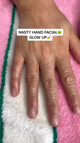 #handglowup #dryskintips #skincareroutine #beauty #spaday #trulybeauty
