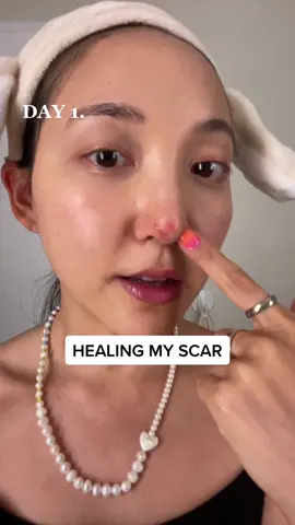 sometimes all your skin needs is a gentle hug (with no acids or harsh patches). #skinrecovery #skinprogress #healing #beautytipswithava