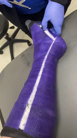 Part 2 cast removed #HavaianasLivreDeCliches #cast #orthopedics #orthopedictechnician #PrimeDayDreamDeals #felipethetaco #orthofelipe #castremoval #castsaw #asmr #countrymusic #emo #summervibes #summervibes #LearnOnTikTok #shortlegcast #AmazonMusicProudHeroes