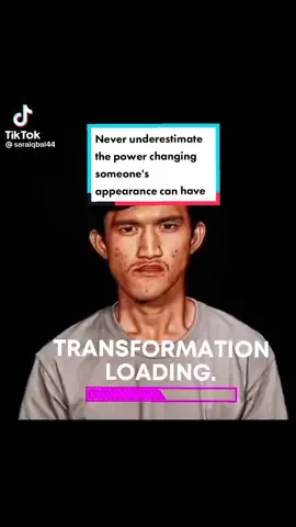Imagine how incredible he feels in that reveal moment? His life will never be the same. NEVER underestimate the positive power changing someone's appearance can have. #surgery #confidence #fullfacerejuvenation #plasticsurgerytranformation #transformation