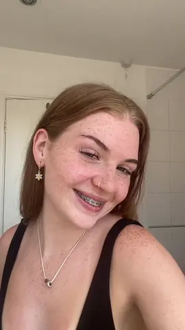 idk what colour braces to get #fyp #braces