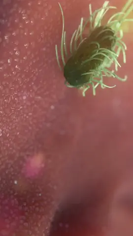 #macrofago #fagocitosis #7omex #infectologia #endocrinologia #medicinainterna #apuntesdemedicina#Salud #Medicina #Medico #Sermedico #Enfermeria #Medstudent #Med #Hospital #Estudiantemedicina #Anatomia #Medicinainterna #Medicine #health