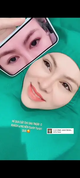 Cắt chỉ sau 7 ngày 🥰 Xinh quá đi