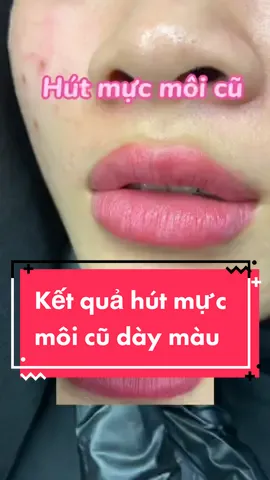 Hút mực môi cũ dày màu #huyennghi_phunxamphongthuy  #huyennghi_phunxam #phunxamthammy