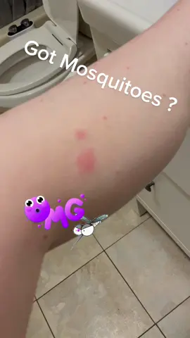 #mosquitoes #mosquitohack #mosquitobites #mosquitobiterelief #windex #windexspraylaugh #windexchallenge #afterbite #afterbiterelief