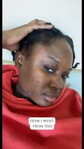 Le produit qui m’a sauvé de l’hyperpigmentation ✨ Les details en commentaire #viral #skincare #fadedtropicals
