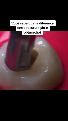 Você sabe qual a diferença entre restauração e obturação? #foryou #dentista #restauracaodentes