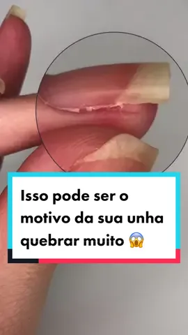 Sua unha ja quebrou por conta disso? Me conta aqui 👇🏼 #nails #unhas #fy