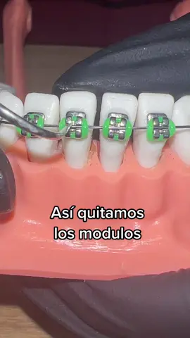 Comenta un emoji verde ✅🤑💚#dentistaentiktok #ortodoncia #brackets #dentista #quevedo #quedate