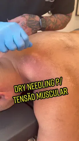Você conhecia essa técnica para tensão muscular? #quiropraxia #quiropraxiarj #fisioterapia #colunavertebral #liberacaomiofascial #torcicolo #colunaajustada #dorcronica #fyp #fy #viral #asmr #studiojun