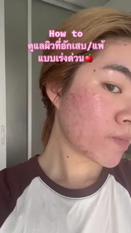 เรียลมาก ทุกคนอย่าตกใจ เมื่อวานผิวระคายเคืองสุด เครียดไม่รู้จะทำไงดี หยิบมอยซ์Atopalmสูตรใหม่มาใช้ กู้ผิวใน1วัน กราบบ🙏🏻 ใครผิวแพ้ง่าย แนะนำให้ลองเลย #ฐาสเตชั่นรีวิว #รีวิวบิวตี้ #รีวิวของดีบอกต่อ #ใช้ดีบอกต่อ #สกินแคร์เกาหลี