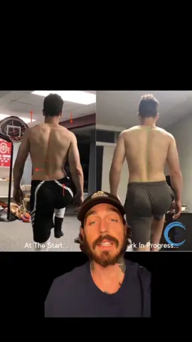 Many of you reached out on my last post about feeling discomfort or imbalance while standing, walking, or running and asked what you could do to fix it. So I wanted to make a follow-up to that video to answer that… #holostic #movement #therapy #restore #balance #function #alignment #fyp #health #foryoupage