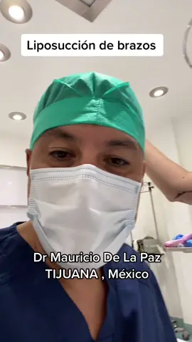 Liposuccion de brazos #lipo #brazos #brazosdelgados #armlift #armlipo