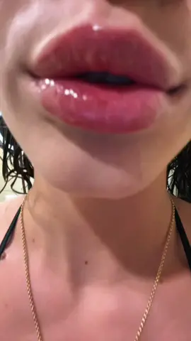 i dont know how i feel ab the freckles