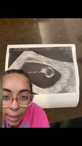 HOW HAS THIS BABY GROWN SO MUCH IN LITERALLY 7 WEEKS 🥺 #greenscreen #firsttimemom #pregnancyjourney #12weekspregnant #PostitAffirmations #WeStickTogether