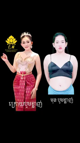ខ្ញុំ ផ្លាស់ប្តូខ្លួនអែង មិនមែនដើម្បីនរណា តែដើម្បីបង្កើនភាពជឿជាក់លើខ្លួនអែង បង្កើនស្នាមញញឹមសំរាប់ខ្លួនអែង បង្កើន សំណាង និង ឱកាស សំរាប់ខ្លួនអែង! #beauty #woman #cambodia #bodyshape #bestliposuctionincambodia #bestplasticsurgeon #bestbeautyclinic #hapiness #beautyqueen #Queen #korea #EM #Love #independent #womanlife