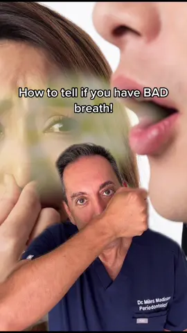 Does your breath SMELL???🥴#greenscreen #gumsurgeon #periodontist #dentist #toothpaste#mouthwash #toothbrush #teeth #gums #fyp
