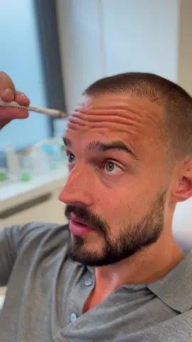 🤨🤨🤨 #ehrenarzt #beautydoc #schönheitschirurgie #faltenreduktion