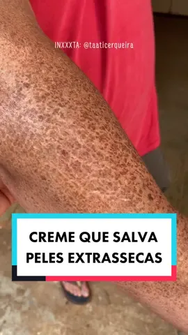 Diquinha valiosíssima! Assim que surtir efeito volto para mostrar o resultado ✌🏻 #causosdatati #receita #creme #peleseca #milagre #receitamilagrosa #fyp #foryou