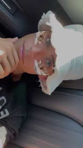 Feel like sun on my skin #italy #travel #fyp