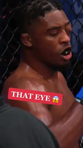 The fight game is DIFFERENT 😳 #mma #mmafighting #injury #warrior #sportstiktok (via @pflmma)