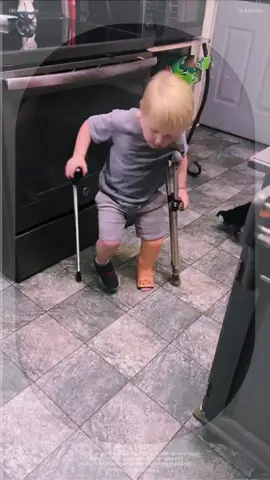 Baobao’s leg is injured.he can walk with crutches #baby #cutebaby #foryou #fyp #lovey #lovey #funnyvideos