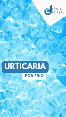 ¿Sabes si padeces de Urticaria por frío ? El test del cubito de hielo nos puede ayudar a diagnosticar #urticaria #alergologomedellin