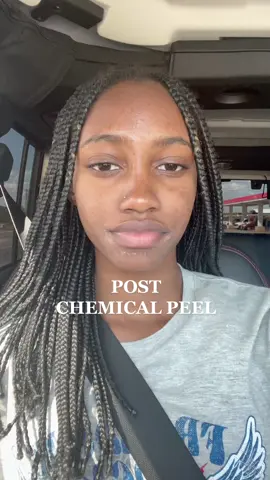 Chemical peel update😍 #fyp #foryoupage #chemicalpeel #microdermabrasion #facialtreatment #postchemicalpeel