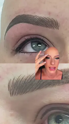 #greenscreen Reply to @fedman146 Reply to @fedman146 which is why the baldie brows have changed my life 🫶🏼@chl0ebean #eyebrows #thebaldiebrows #alopeicaawareness #alopecia #hairloss #microbladding #eyebrowhelp #temporarytattoo