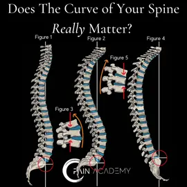 #spine #health #fyp #lordosis #kyphosis #posteriorchain #curves #backpain #backpainrelief