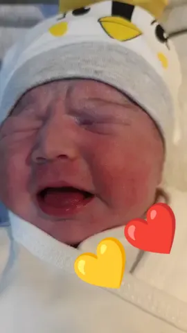 #hamileanne #hamileyimanneyim #gebeliktesti #gebelikbelirtileri #ceserean #sezeryandoğum #sezeryandogum #normaldelivery #normaldoğum #yenidoganbebek #yenidoğanbebek #yenidoğan #yenidogan #babiesontiktok #jinekologdrmuratkayaoglu #jinekologmuratkayaoglu #newbornsoftiktok #newbornphotography #newborns #newbornvsnowchallenge #newbornphotoshoot #newbornsleeptips