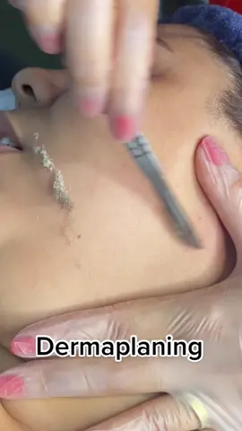 Dermaplaning - o Peeling famos sem intervenção de ácidos,o queridinho das atrizes de Hollywood.