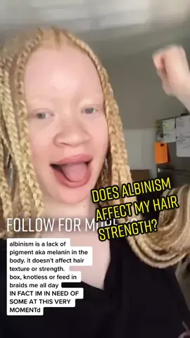 Replying to @canoncosplays #albinism #albinismawareness #albinismisbeautiful #albinismcheck #albinismqueen #blackgirlbraids  #blackgirl #blackgirlmagic #blackgirltiktok #blackgirls #blackgirlblonde #naturalhairtiktok