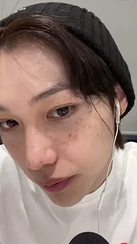 his freckles 😿❤️‍🩹 #straykids #felix #fypシ