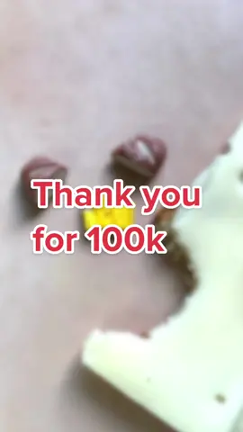 Thank you for 100k !!You made my day!!! #thankyou #100k #fypage