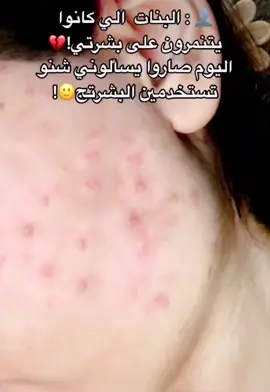 بكج سيروم وتونر المعجزه بالشاي الاخضر متوفر 😍✅#اكسبلور #لايككات생일축하해사랑해❤🦄 #لايك_اذا_حبيتو_الفيديو🖤 #لايك❤️❤️ #لايك #ريال_مدريد #ريلز_explor #ريلز #ريلز_العراق #لايفوتكم_المقطع #لايكا #لايكات생일축하해사랑해❤🦄ومت #fyp #fypシ #dance #dan #عنايه #صح #اكس #اكسبلور #explore #explore #لايك❤️😘تعليق💬حلو #لايك_ومتابعه_وفولو #فولو #فولفو #اضافهہ💙 #مشاهير_تيك_توك #مشاهير #تيك_توك #انستا #تيك_توك_عرب #جمال #اكسبلور_تيك_توك #اكسبلورر #اكسبلور #ريلز #ريلز_explor #ريلز_العرب ##ريلز_العراق #لايك #لايك❤️❤️ #لايك_اذا_حبيتو_الفيديو🖤 #لايككات생일축하해사랑해❤🦄 #fyp #fypシ #fy