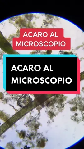 Da guardare fino alla fine..😳🔬🦠 #microscopio #biologia #acaro #acqua