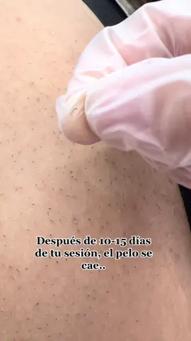 Instagram: clinicafibra. Asi funciona la depilación láser #depilaciónlaser #concepcion #limpiezafacial #kinesiologiadermatofuncional #viral #parati