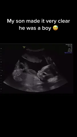 I cant wait to show him this when he’s older 😅 #fyp #funny #viral #foryoupage #sonogram
